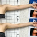 뱅뱅홈플러스 | 안산팔뚝관리 메리미뷰티 매끈한 상체 라인슬림 관리 추천 웨딩 신부관리 다이어트 추천