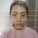 아미율한의원 | 얼굴비대칭교정 후기 강남 아미율 한의원 5회차