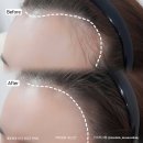 햇빛헤어라인 - 북구 | 햇빛헤어라인