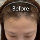 대지오일 | 대구 오일공스튜디오 헤어라인 왁싱 후기 💇‍♀️✨ | 저온·저자극으로 자연스럽게!