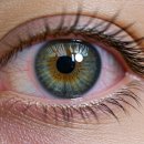 드림안과의원 이미지