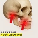 새벽치과의원 | 이갈이 치료, 치과의사가 가족을 치료한 방법 궁금해요?