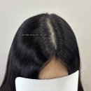 하얀 | 김포smp 하얀두피 커버후기