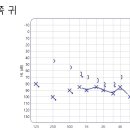 벨톤보청기 중곡지사 이미지