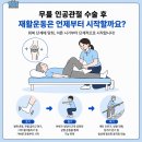 관절 근육 강화 운동 | 인공관절 수술 후 재활 운동, 회복을 돕기 위한 단계별 접근법
