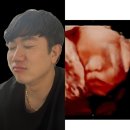 (주)구암약품 | 임신 25주 ~ 28주 +4일, 입체초음파 실패 후기 , 뒤늦은 주수사진 찍기