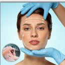 메디프로 | 송도/8공구/에스테틱/송도윤곽술/ JH윤곽술 입안마사지 얼굴리프팅후기