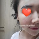 블리스메디 이미지