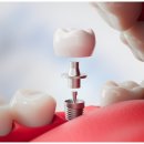 가우정인 이미지