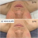 피부애 - 동구 율하동 | 피부애