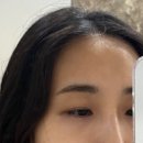 뷰티콩드아카데미 | 대구 두류역 뷰티콩드아카데미에서 눈썹문신 잔흔제거 후기