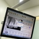 진종호치과의원 | 대구 서구 진종호치과에서 치아 신경치료 받은 썰 😢 20대 치아파절 풀스토리 🦷