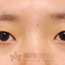 에이엠성형외과의원 네이버블로그