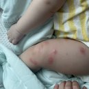 정다운소아청소년과의원 이미지