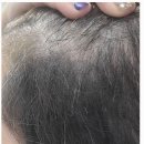 블랭크smp 이미지