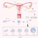 수정-129 이미지