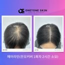 스킨모발팡팡