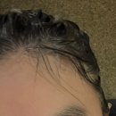 (집)씨스페이스 광명소하점 | 위기의 두피 광명찾다 송도 두피 클리닉 모바이오 송도점 방문