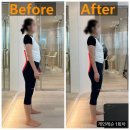 전방프라자 | [부평 필라테스 후기] 전방경사 개선 + 근력 향상! 회원님이 직접 느낀 변화 이야기