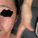 리윤피부관리