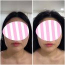 임정미에스테틱 | 대전 피부관리 마사지 임정미에스테틱, 어깨 목 푸니까 얼굴이 작아졌어요!