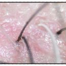 금곡신미주아파트 | 중년 여성 두피 탈모 관리 앙포레 헤드스파로 수원 나다움 헤어에서 관리하세요.