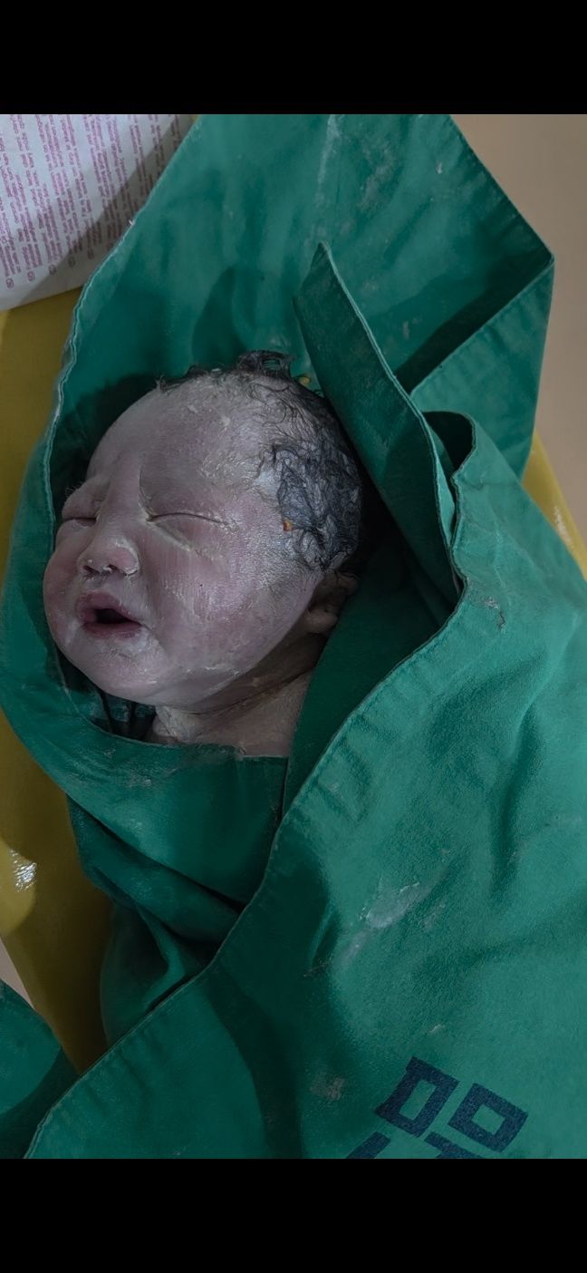 울산 중구 맘스여성병원 제왕절개 수술 후기(하반신마취, 응급제왕, 역아, 수축)