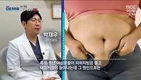 중년 여성이 내장지방이 늘어나는 원인, MBC 240505 방송