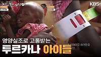 영양실조에 고통받는 투르카나 아이들 ＂10명 중 3명은 중증 영양실조＂ | KBS 240512 방송 