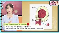 [핫뉴스 브리핑] 귀에 고무줄 끼우면 얼굴 부기가 빠진다? | KBS 240517 방송 