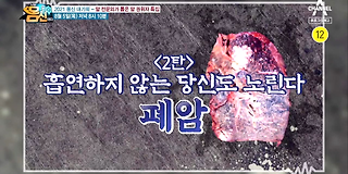 나는 몸신이다 343회