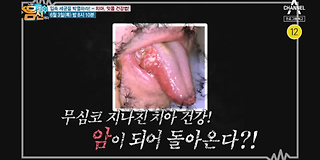 나는 몸신이다 334회